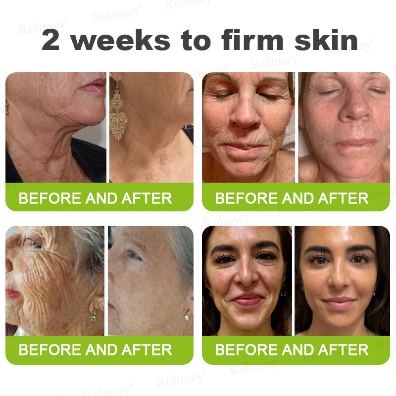 Rolimey® Botox & Vita-A Retinol Shot Wrinkle-Lift Tightening Cream upsell