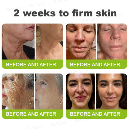 Rolimey® Botox & Vita-A Retinol Shot Wrinkle-Lift Tightening Cream upsell