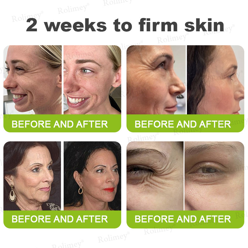 Rolimey® Botox & Vita-A Retinol Shot Wrinkle-Lift Tightening Cream upsell