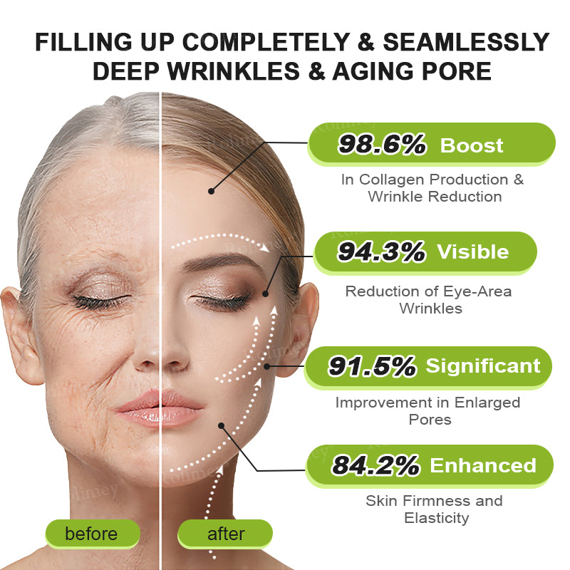 Rolimey® Botox & Vita-A Retinol Shot Wrinkle-Lift Tightening Cream upsell