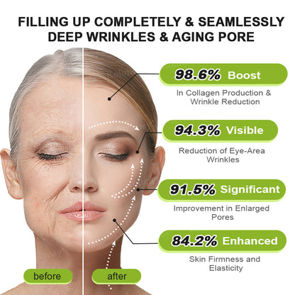 Rolimey® Botox & Vita-A Retinol Shot Wrinkle-Lift Tightening Cream upsell