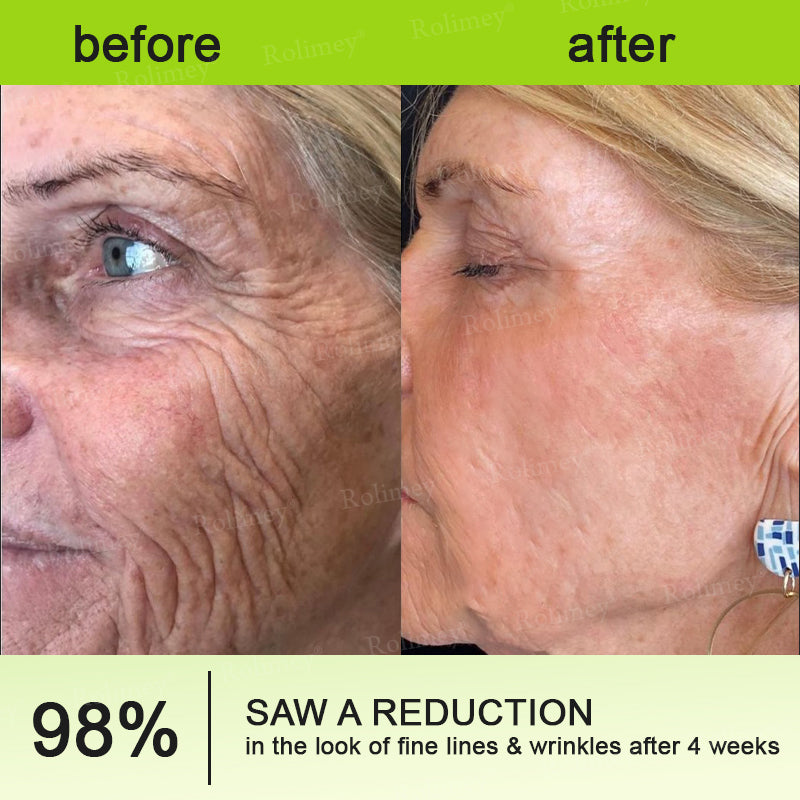 Rolimey® Botox & Vita-A Retinol Shot Wrinkle-Lift Tightening Cream upsell