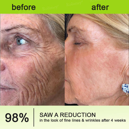 Rolimey® Botox & Vita-A Retinol Shot Wrinkle-Lift Tightening Cream upsell