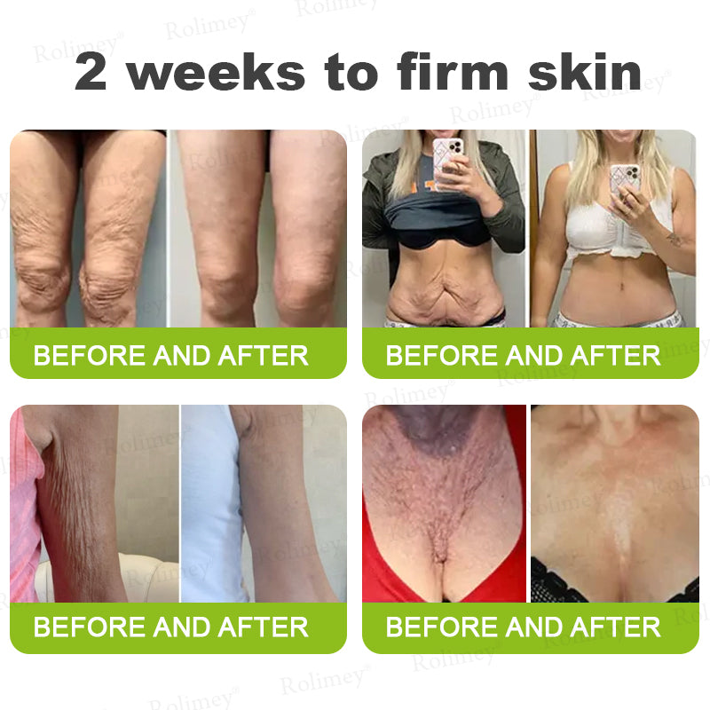 Rolimey® Botox & Vita-A Retinol Shot Wrinkle-Lift Tightening Cream upsell