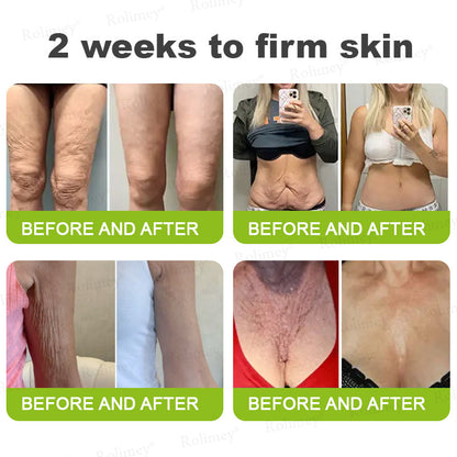 Rolimey® Botox & Vita-A Retinol Shot Wrinkle-Lift Tightening Cream upsell