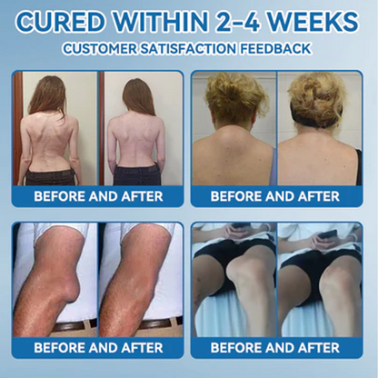 𝑩𝒐𝒐𝒕𝒔 𝑶𝒏𝒍𝒊𝒏𝒆 𝑺𝒕𝒐𝒓𝒆 | Zvoe𝐯𝗼® 𝗕𝖯𝖢-𝟏𝟓𝟕 Joint Healing Cream (🏅The Ultimate Solution for Muscle Aches, Arthritis, Joint Pain, Nerve Pain, Inflammation, and Stiffness) upsell