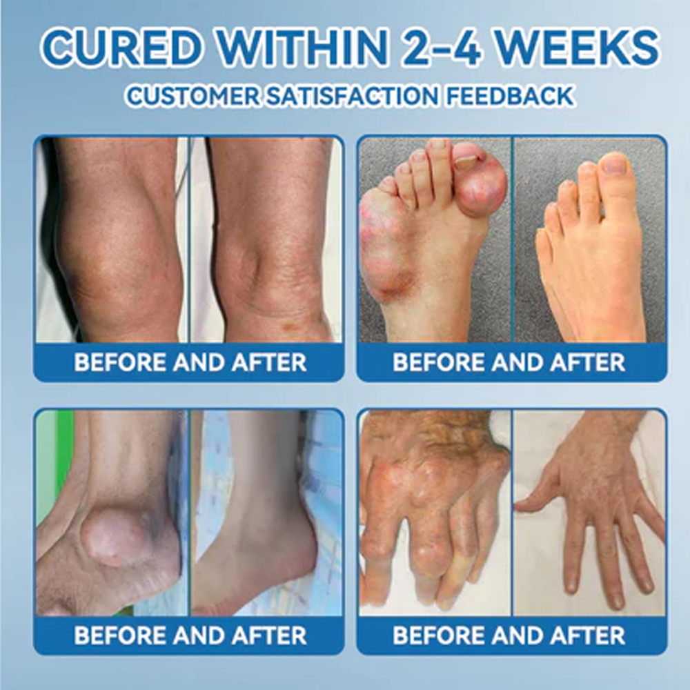 𝑩𝒐𝒐𝒕𝒔 𝑶𝒏𝒍𝒊𝒏𝒆 𝑺𝒕𝒐𝒓𝒆 | Zvoe𝐯𝗼® 𝗕𝖯𝖢-𝟏𝟓𝟕 Joint Healing Cream (🏅The Ultimate Solution for Muscle Aches, Arthritis, Joint Pain, Nerve Pain, Inflammation, and Stiffness) upsell