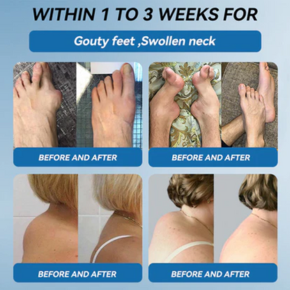 𝑩𝒐𝒐𝒕𝒔 𝑶𝒏𝒍𝒊𝒏𝒆 𝑺𝒕𝒐𝒓𝒆 | Zvoe𝐯𝗼® 𝗕𝖯𝖢-𝟏𝟓𝟕 Joint Healing Cream (🏅The Ultimate Solution for Muscle Aches, Arthritis, Joint Pain, Nerve Pain, Inflammation, and Stiffness) upsell