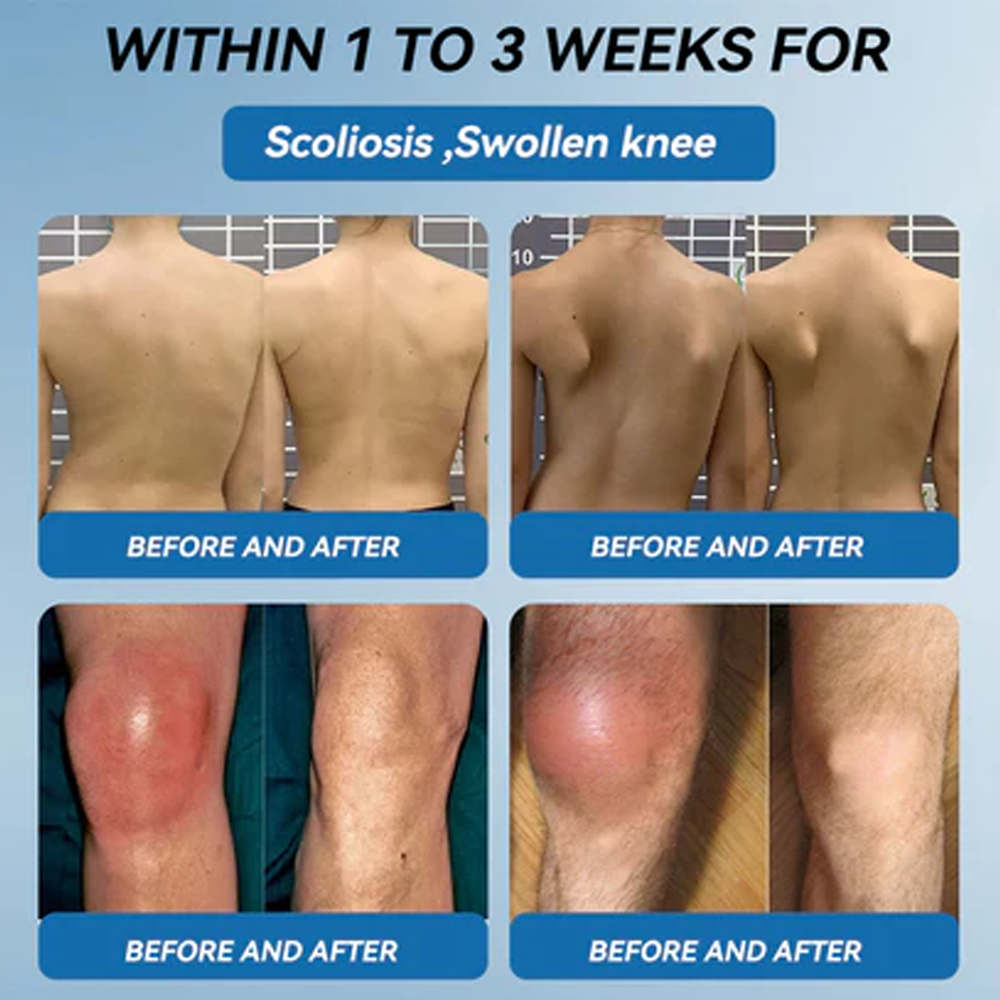 𝑩𝒐𝒐𝒕𝒔 𝑶𝒏𝒍𝒊𝒏𝒆 𝑺𝒕𝒐𝒓𝒆 | Zvoe𝐯𝗼® 𝗕𝖯𝖢-𝟏𝟓𝟕 Joint Healing Cream (🏅The Ultimate Solution for Muscle Aches, Arthritis, Joint Pain, Nerve Pain, Inflammation, and Stiffness) upsell