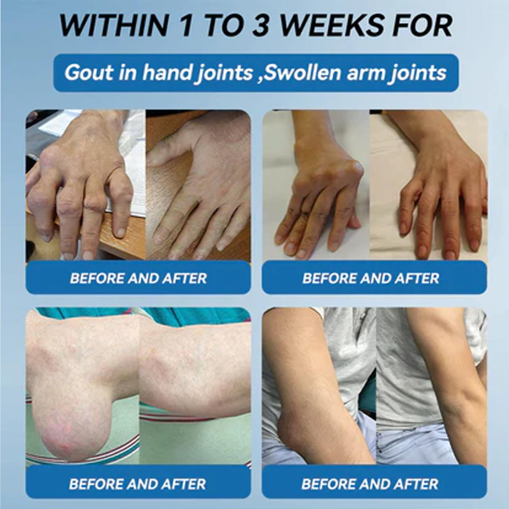 𝑩𝒐𝒐𝒕𝒔 𝑶𝒏𝒍𝒊𝒏𝒆 𝑺𝒕𝒐𝒓𝒆 | Zvoe𝐯𝗼® 𝗕𝖯𝖢-𝟏𝟓𝟕 Joint Healing Cream (🏅The Ultimate Solution for Muscle Aches, Arthritis, Joint Pain, Nerve Pain, Inflammation, and Stiffness) upsell
